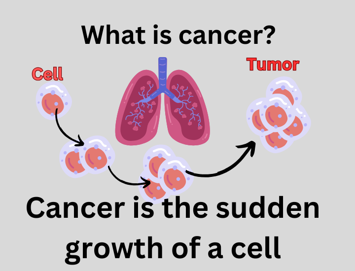 Russia created cancer Vaccine